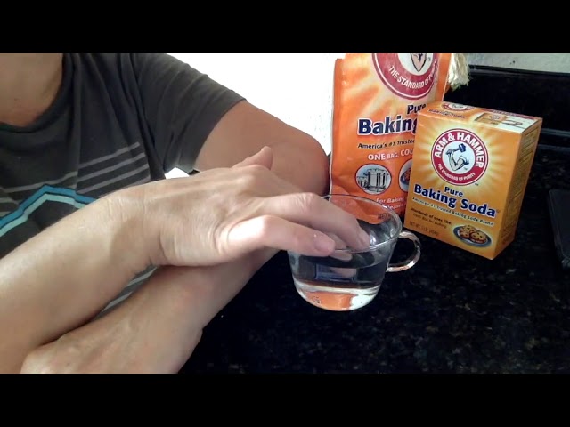 От Укусов Комаров 100% Помогает