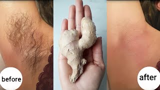 Stop shaving! Here's how to permanently get rid of facial and body hair screenshot 3