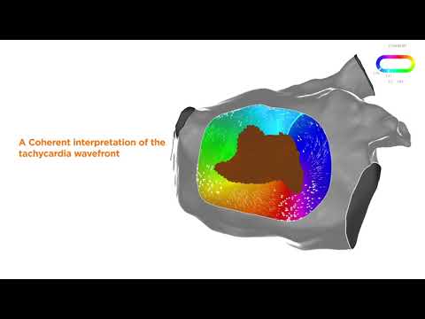 CARTO Prime® Module: Coherent Mapping Explained