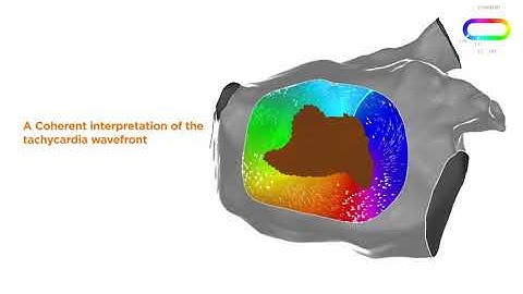 CARTO Prime® Module: Coherent Mapping Explained