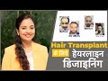 Hairline Designing for Hair Transplant (हेयर ट्रांसप्लांट के लिए हेयरलाइन डिजाइनिंग)