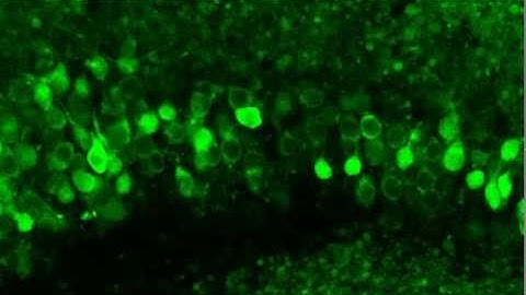 Monitoring neuronal activity in brain slices from a 2 year old Thy1-GCaMP3 transgenic mouse