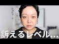 乳がんで左胸全摘出🎗術後から退院まで【38歳で乳がんステージ2】