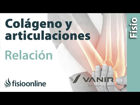 Vídeo: Suplementos Articulares: 9 De Las Mejores Opciones Para El Dolor Articular