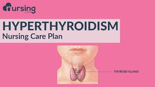 Nursing Care Plan for Hyperthyroidism  (Nursing Care Plan Tutorial)