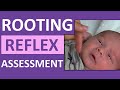 Rooting Reflex in Newborn Infant Baby | Pediatric Nursing Assessment
