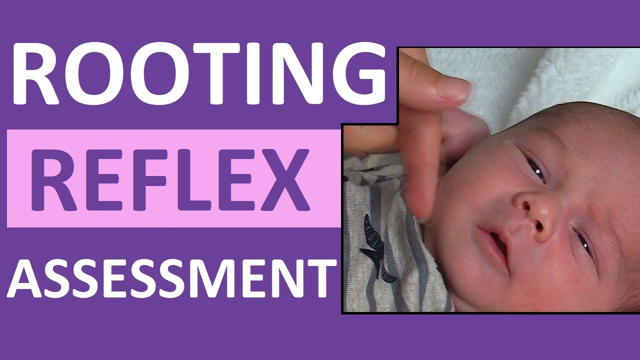 Rooting Reflex in Newborn Infant Baby | Pediatric Nursing Assessment ...