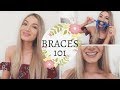 Braces: Everything You Need To Know | Price, Pain, Duration, Types!