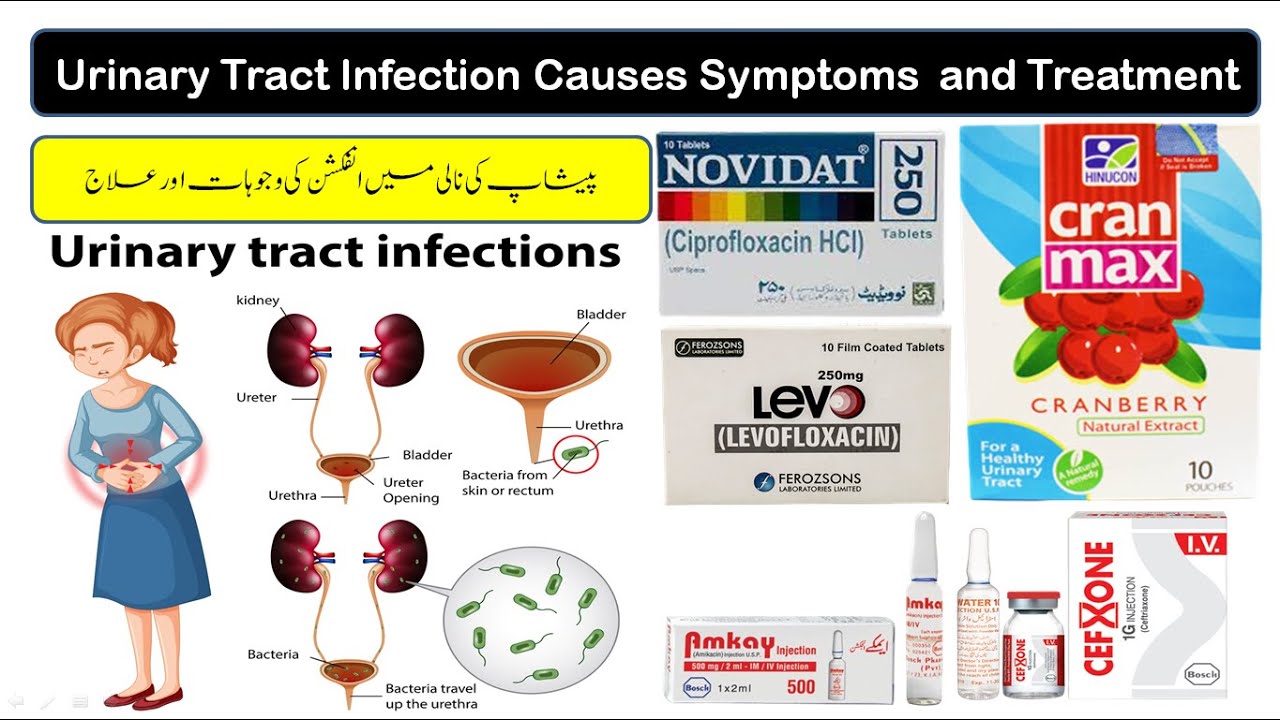 Urinary Tract Infection Symptoms Causes And Treatment Peshab Ki Nali Ka Infection Youtube 