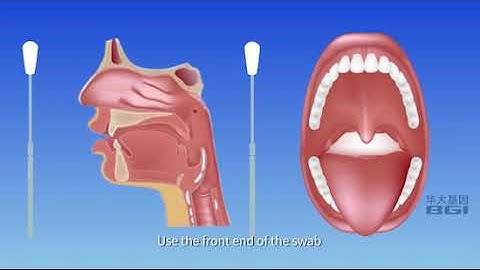 [Danish]Instruction of oropharyngeal swab Self-sampling kit for 2019 Novel Coronavirus testing