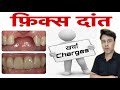 fix teeth kaise lagate hai | फ़िक्स दांत कैसे लगाए । fix teeth ka kharcha