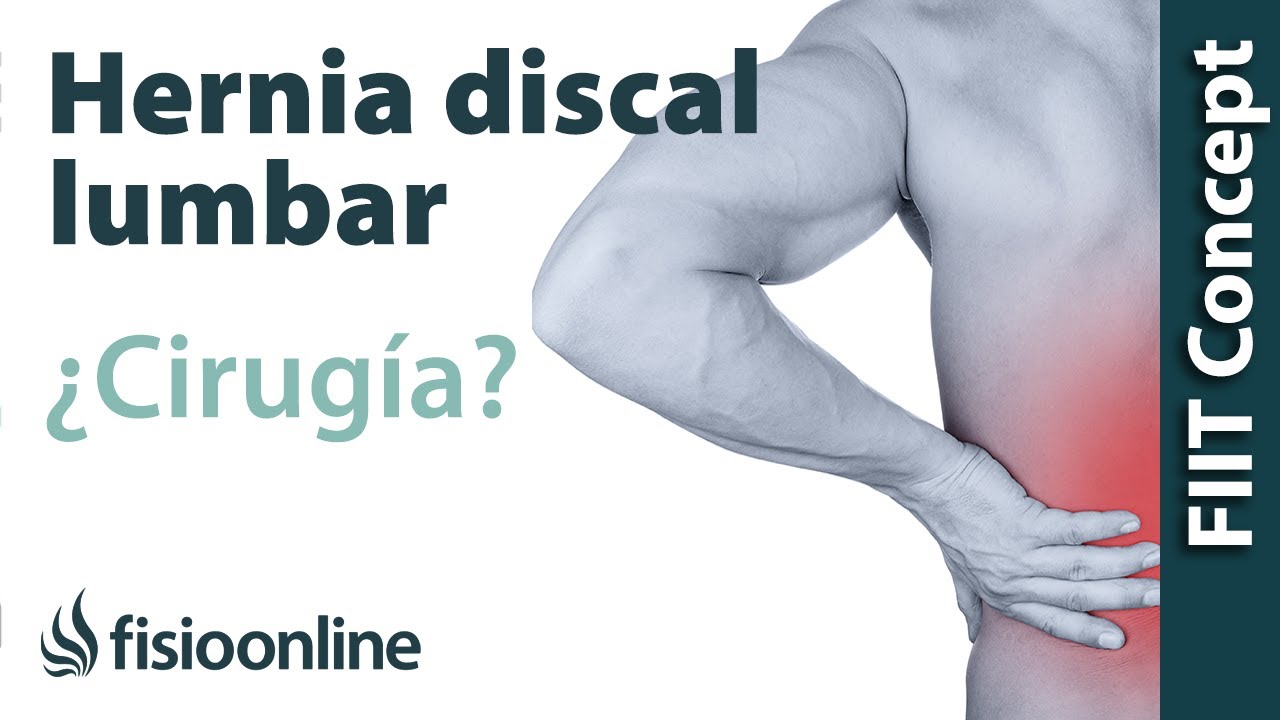 Se puede correr con hernia discal