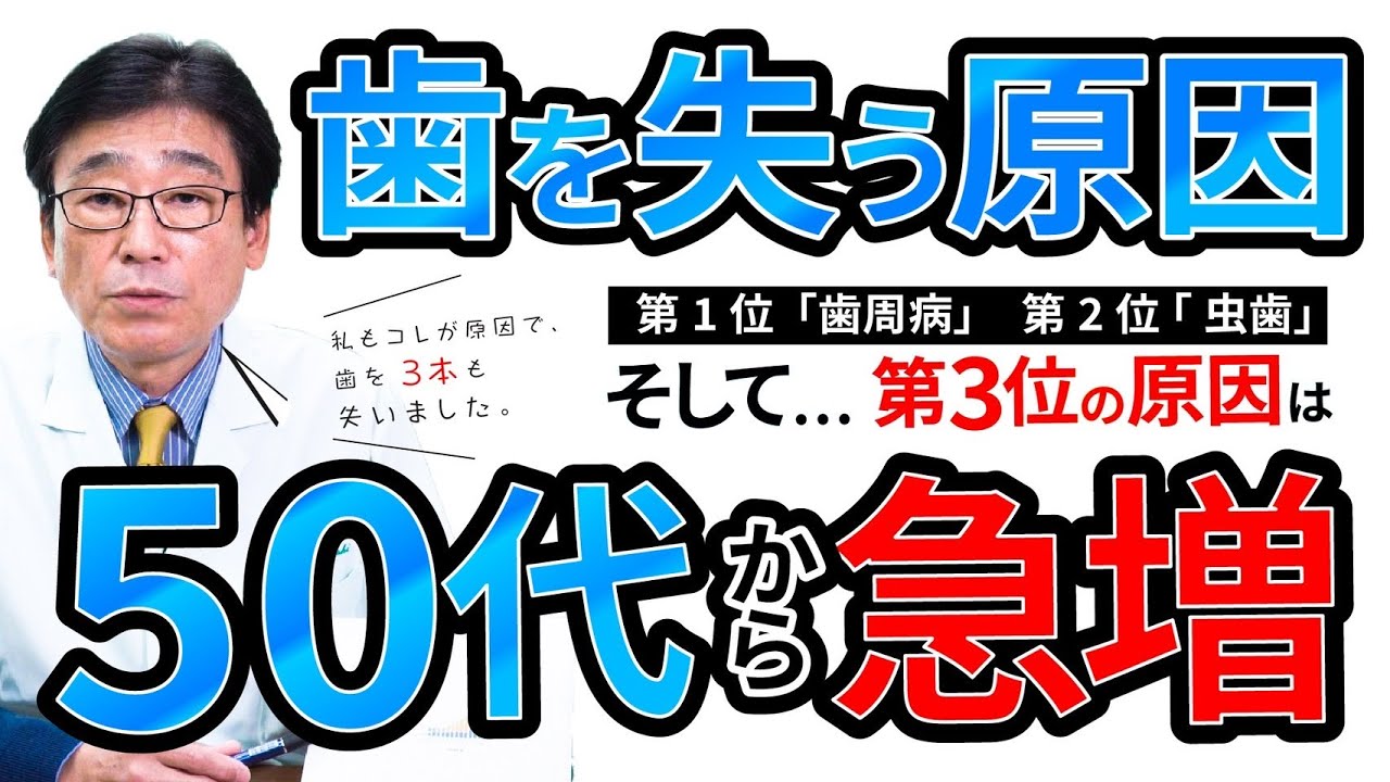 【  入れ歯・義歯  】 歯を失う原因、第３位・・・それは、 50 代 から 急増する「〇〇〇〇」だった・・・私 も コレ が 原因 で 3本 歯 を 失いました ！