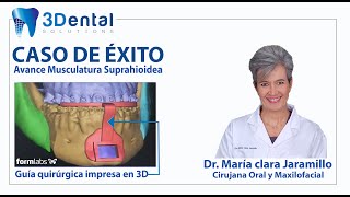 Avance Musculatura Suprahioidea, Caso de Éxito