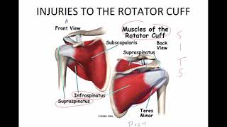Orthopedic fractures diagnosis and treatment  USMLE Step 2