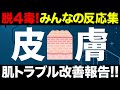 聞き流し 肌トラブル 顔の赤み ニキビ ヘルペス 粉瘤 乾癬 尋常性乾癬 イボ が改善したコメント集めてみた 4毒抜きを実践したみんなの反応集 聞き流し 肌トラブル 顔の赤み ニキビ ヘルペス 粉瘤 乾癬 尋常性乾癬 イボ が改善したコメント集めてみた 4毒抜きを実践したみんなの反応集