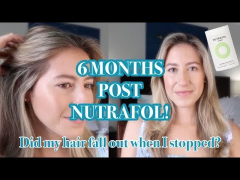 6 MONTHS AFTER STOPPING *NUTRAFOL* REVIEW | Does your hair fall out when you stop Nutrafol?