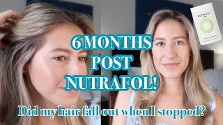 6 MONTHS AFTER STOPPING *NUTRAFOL* REVIEW | Does your hair fall out when you stop Nutrafol?