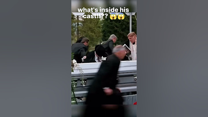 top assassins, hid a handgun in his cast!!!!!