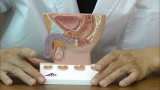 膀胱や前立腺など男性の骨盤内臓器を観察できるミニ模型│K41