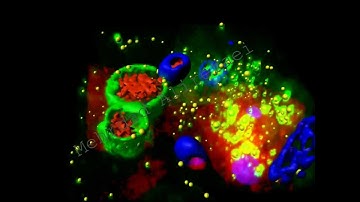 Real & 3D model autophagosomes & megaphagosomes in dsRED-CVB3 infected pancreas