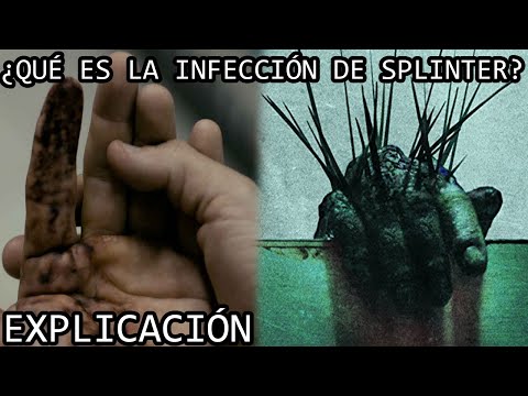 Video: ¿Qué significa splinter?