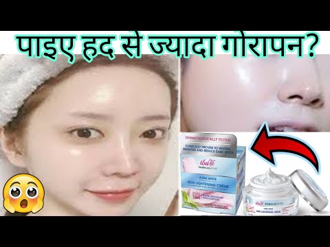 पाइए हद से ज्यादा गोरापन?| Iba Skin Whitening Cream | Reduce Dark Spots, Pigmentation, Uneven Skin?  @KAngelBEB