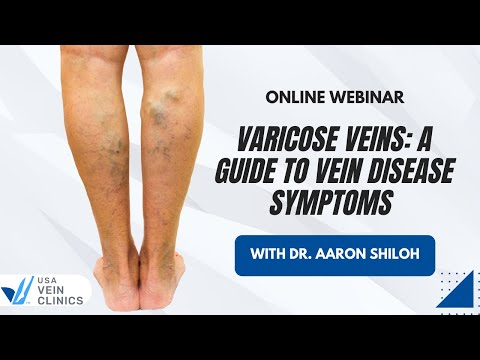 I'm a Vascular Surgeon: Here's My Best Advice for Preventing Varicose Veins  and How I Treat Them