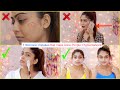 7 SKINCARE MISTAKES That Can Make ACNE & Large PORES Worse!