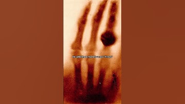 Discovery of X Rays #history  #discovery #WilhelmConradRoentgen #shorts