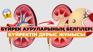 🧲БҮЙРЕК ауруларының біз мән бермейтін БЕЛГІЛЕРІ❌БҮЙРЕГІМІЗДІҢ ДҰРЫС жұмыс жасауы #бүйрек #денсаулық