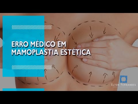 Vídeo: Mulher Removeu Os Dois Seios Por Erro Médico