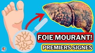 LE FOIE est en train de MOURIR ! 15 Signes Bizarres de DOMMAGES AU FOIE !