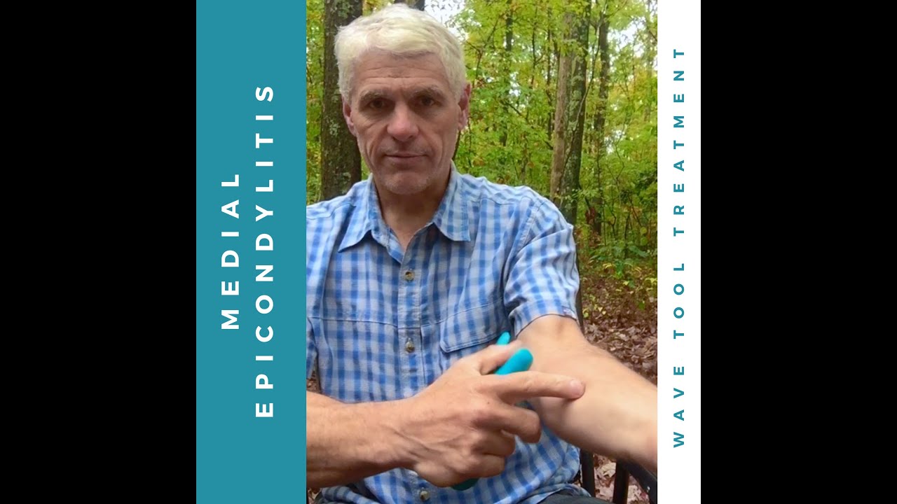 Medial Epicondylitis (golfer's/climber's elbow) and the Wave Tool with