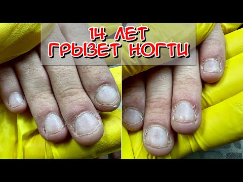 14 лет грызет ногти / маникюр / маникюр для подростка