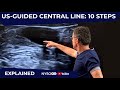 US-Guided Central Line: 10 Steps - Crash course with Dr. Hadzic