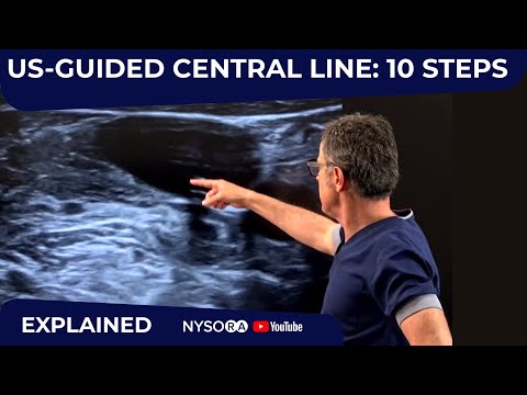 Image of US-Guided Central Line: 10 Steps - Crash course with Dr. Hadzic