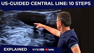 USGuided Central Line: 10 Steps  Crash course with Dr. Hadzic