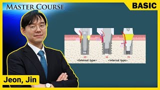 [Master Course Season2  BASIC] Understanding Implant Abutment