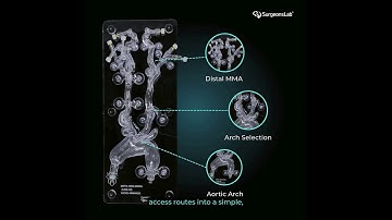 Seamless Aortic Arch to Distal MMA Access | Advanced 3D Medical Simulation Model