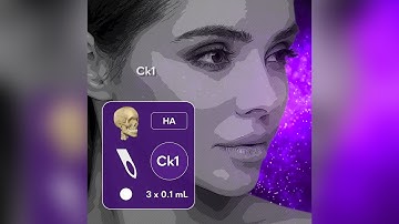 MD Codes Review - Ck1 Anchor