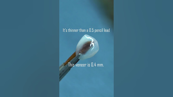What happens if the veneer breaks? #onedaydentistry
