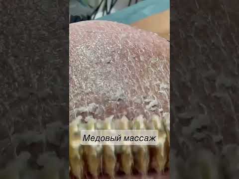 Медовый массаж, работаем комплексно на подтяжку кожи