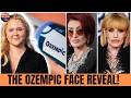 15 Celebrity Ozempic Transformations That Shocked the Internet | Then and Now 2026