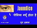 How serious is jaundice? - YouTube