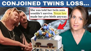 Texas forced a woman pregnant with conjoined twins to have a C-section...