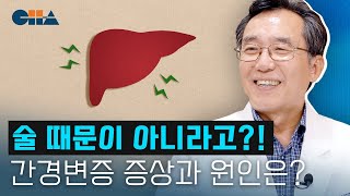 술 때문 아님! 간이 딱딱해지는 간경화(간경변증) 초기 증상 및 원인은? (강남차병원/차움 소화기내과 한광협 교수)