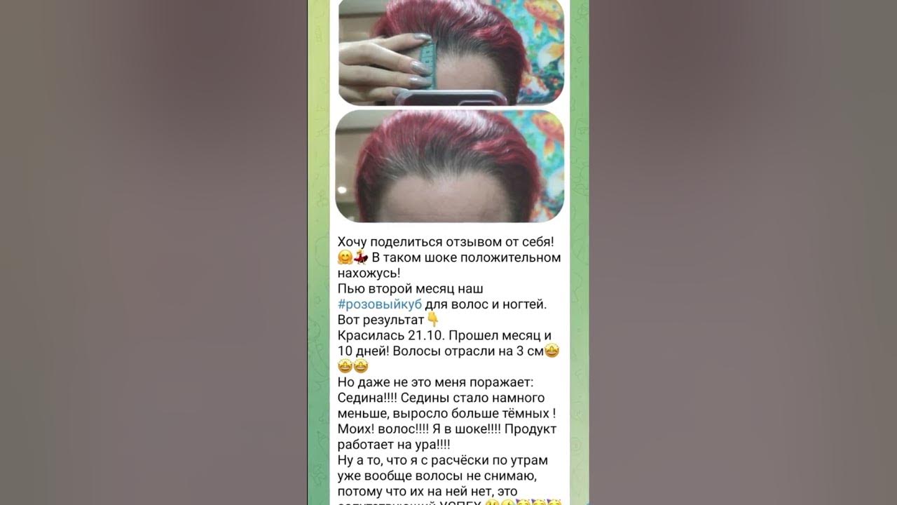 Плохо растут волосы Выпадают волосы Витамины Минералы для волос Розовый ...