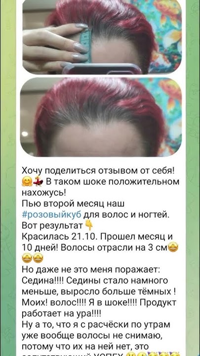 Плохо растут волосы Выпадают волосы Витамины Минералы для волос Розовый ...