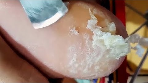 How to get a clean foot?